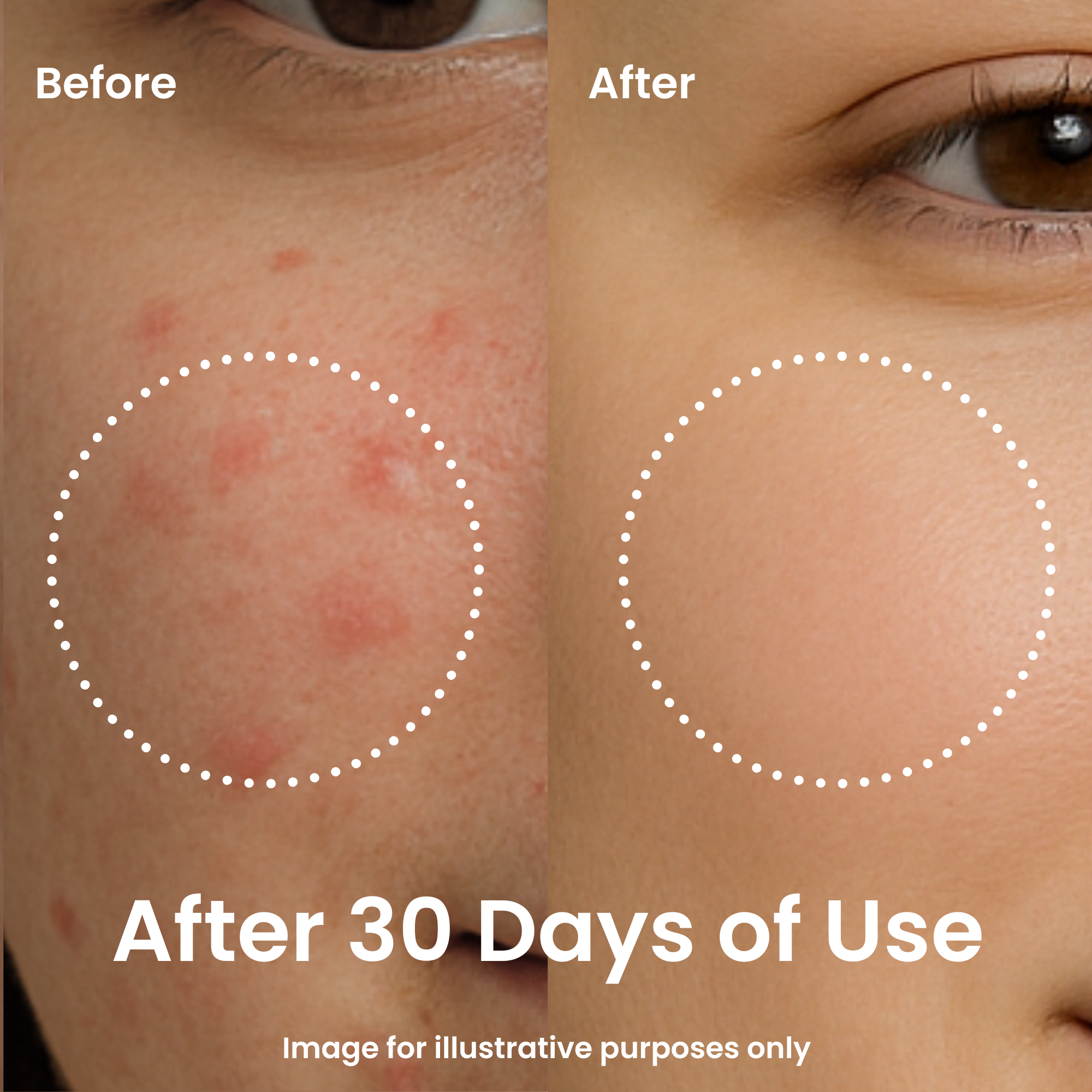 ViTassie Forest Energy Vitamin Ampoule Spot Solution