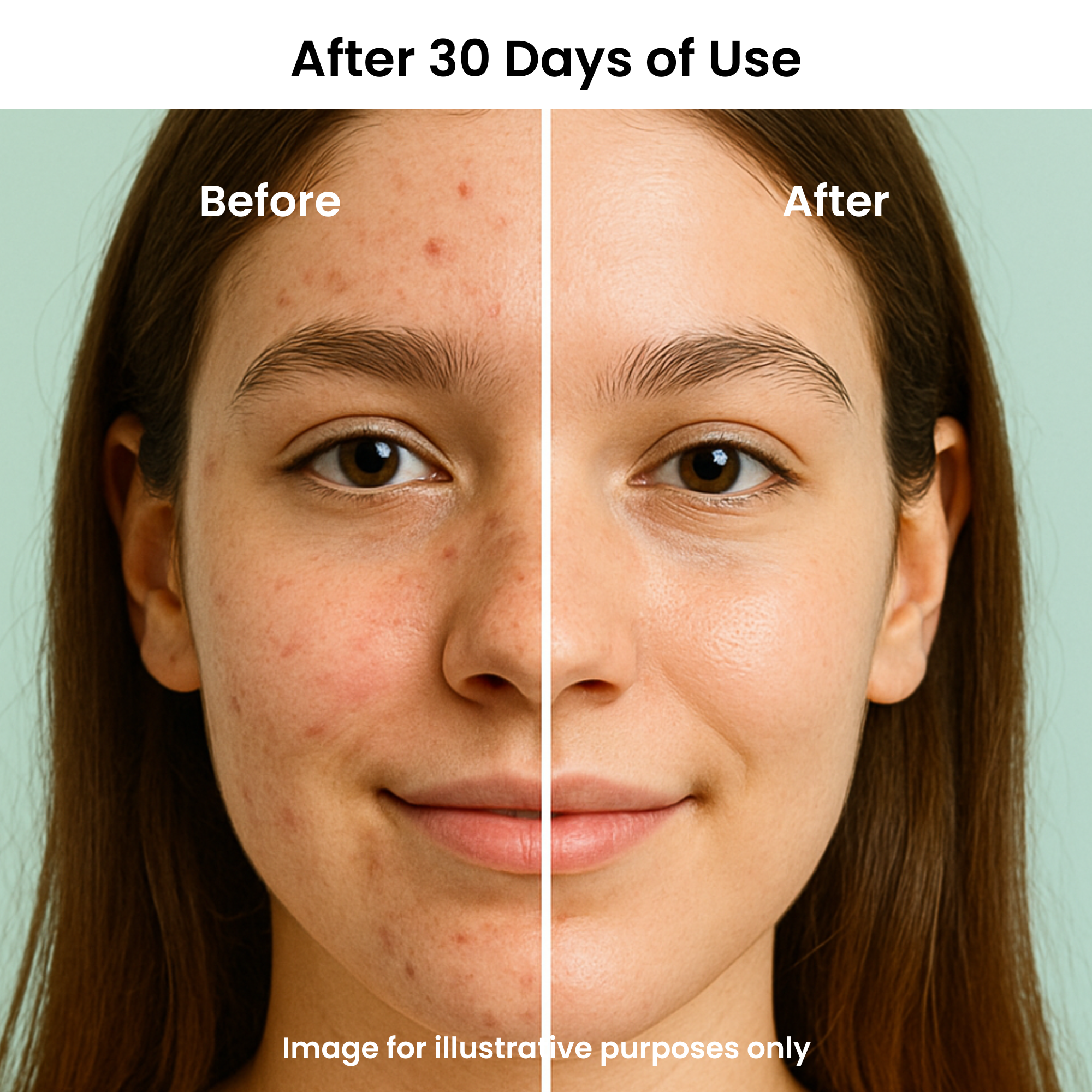 FEAT BY YOU ViTassie Blemish Buster & Hydrate Duo
